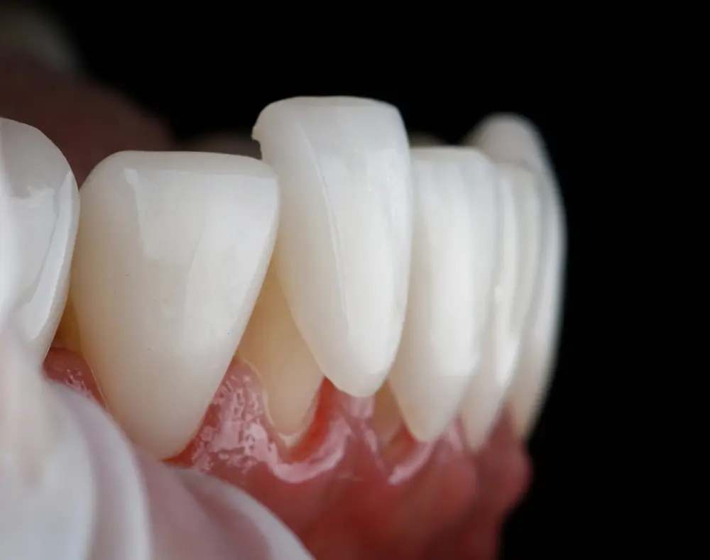 Close-up of a set of artificial teeth with white crowns and pink gums against a black background.