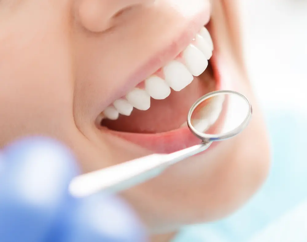 Close-up of a person smiling with teeth visible, a dental mirror reflecting the teeth inside the mouth, and a hand wearing a blue glove holding the mirror.