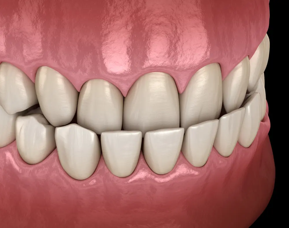 Close-up of a set of upper and lower teeth with gums, showing detailed textures and realistic colors against a dark background.