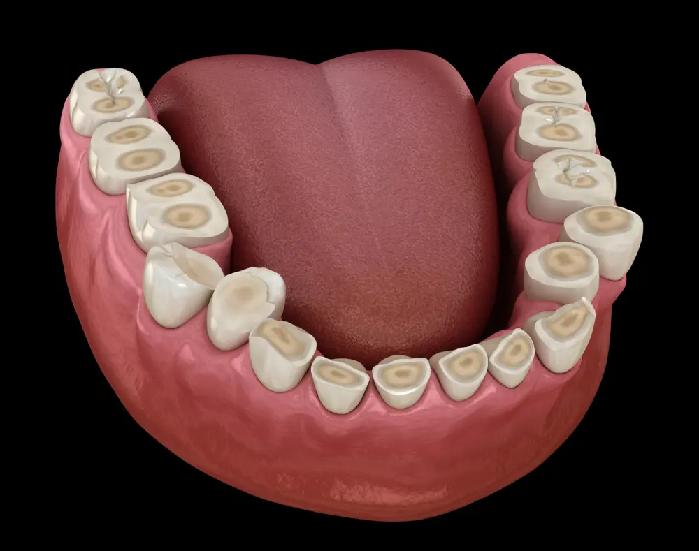 Close-up of a set of human teeth and pink gums with a red tongue centered behind the upper front teeth, against a black background.