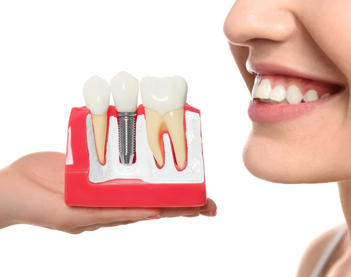 A smiling woman showing teeth near a dental model with a dental implant and surrounding natural teeth.