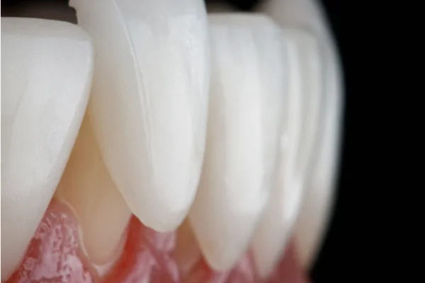 Close-up of artificial teeth and gums against a black background, showing detailed textures and alignment of the dental prosthesis.