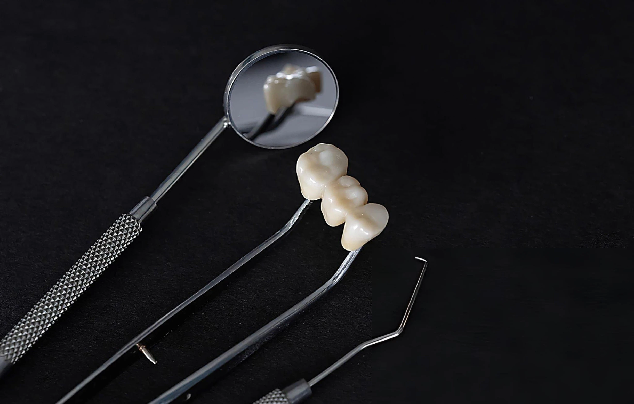 Dental Bridges